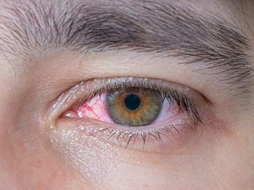 Augen Und Nasensalbe Heilt Wunden Wirksam Bepanthen