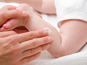 Neurodermitis Beim Baby Erkennen Behandeln Bepanthen
