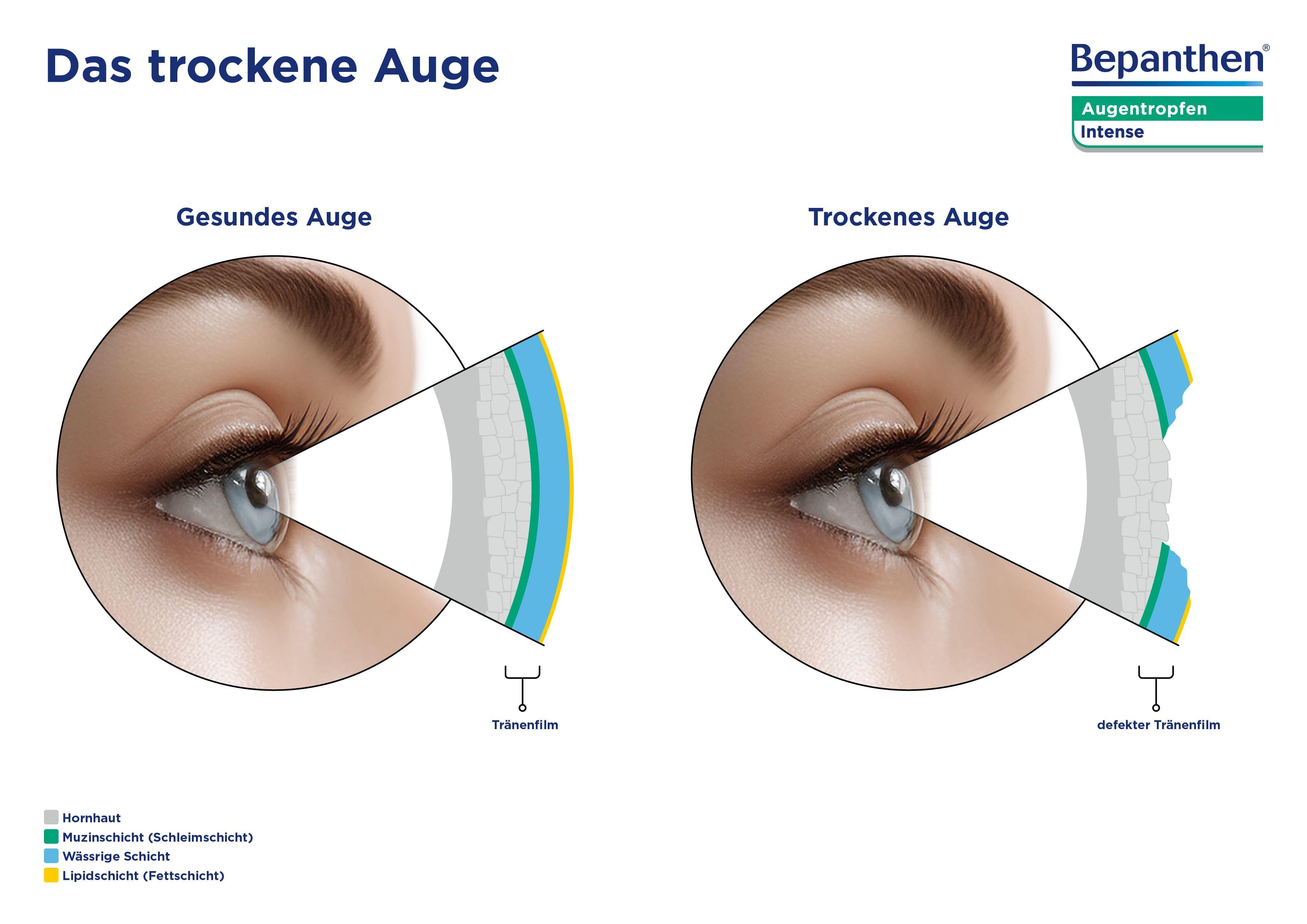 BVBE-0001-0002_Grafiken-Bepanthen-Intense_230319_V8.2_RZ4